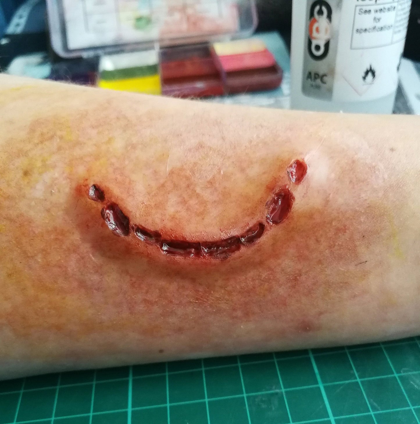 Arm with a bloody half bite on it